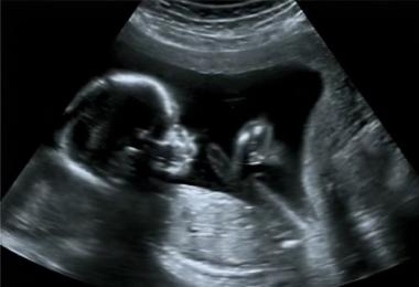 Kedy začínajú pohyby plodu počas tehotenstva a ako ich rozpoznať?