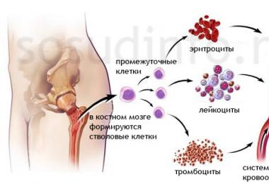 Trombocitopenija – ligos priežastys ir simptomai