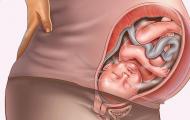 गर्भावस्था के दौरान गर्भाशय की टोन: लक्षण, कारण, परिणाम